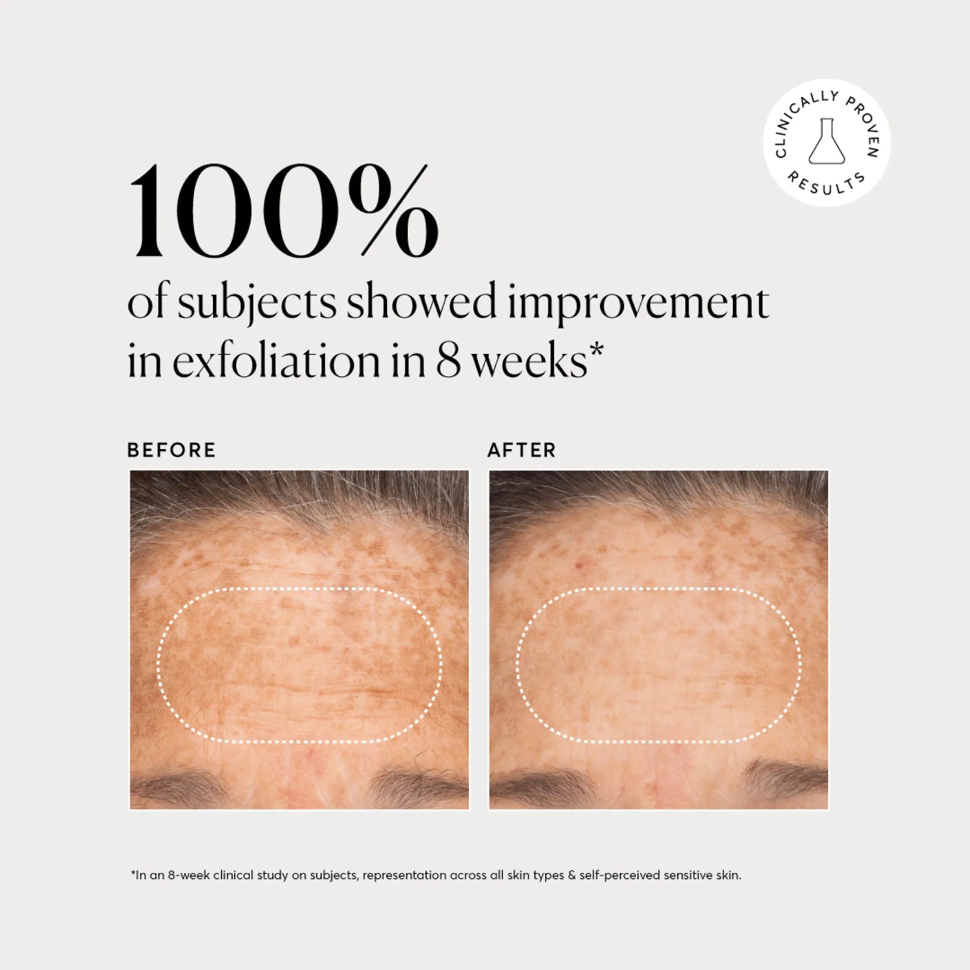bha-liquid-exfoliant-2-n6 NATR-10027-Alt-Images-BHA-Liquid-Exfoliant-2_-03.webp