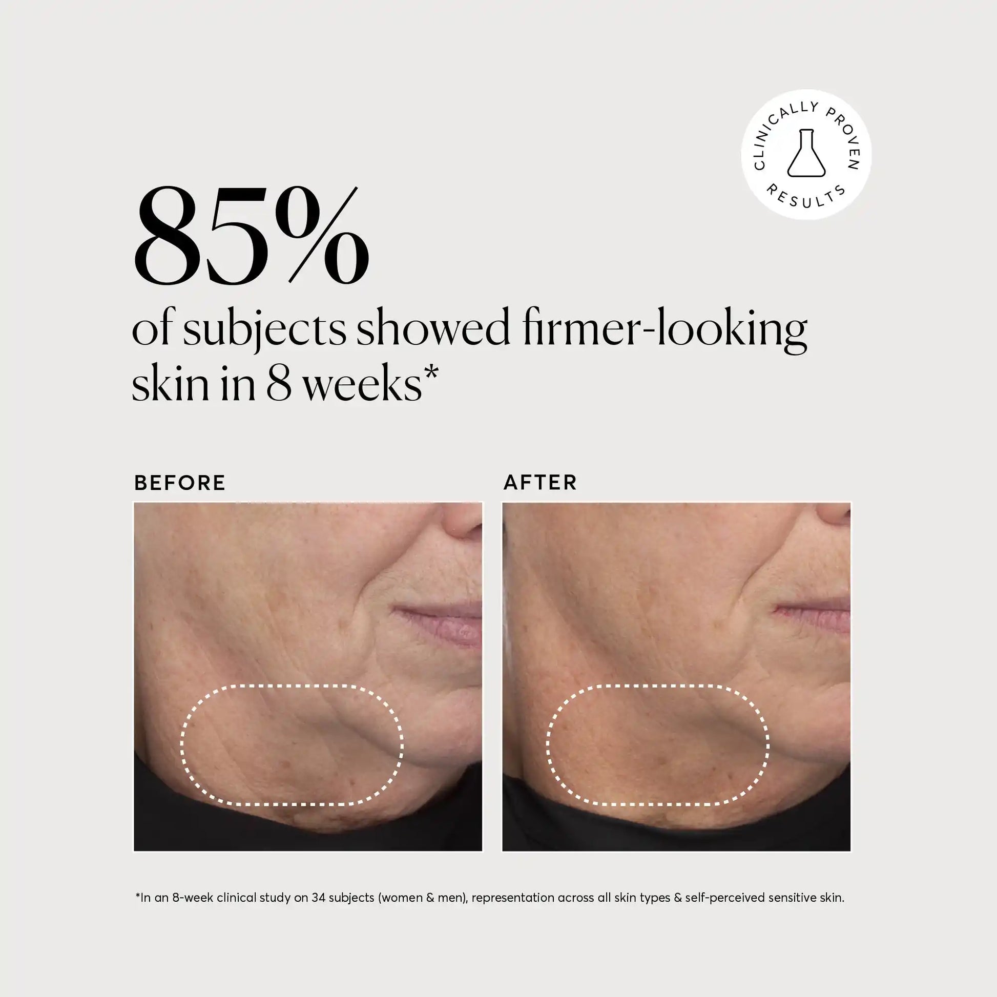 retinol-complex-serum-n1 NATR-10034-Alt-Images-Retinol-Complex-Serum-04.webp